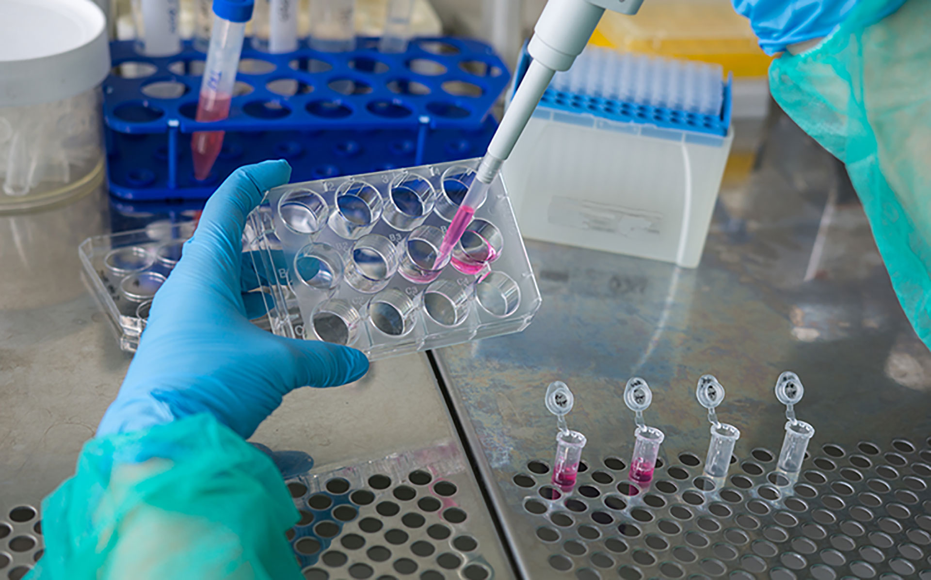 Сеченовский Университет запустил производство биомедицинских клеточных продуктов