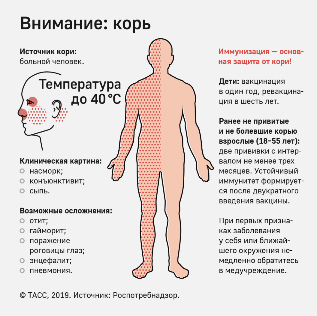 В РФ за полгода зарегистрировали 8 тыс. случаев кори