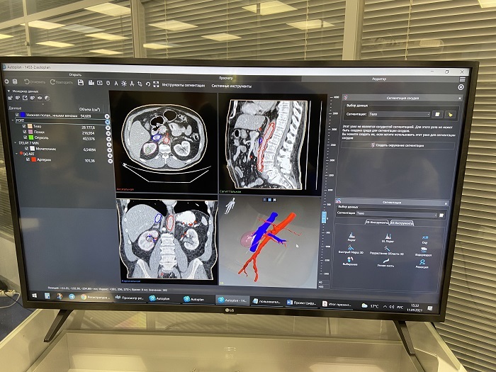 Ученые Сеченовского Университета приняли участие в конференции «3D-технологии в клинической анатомии»